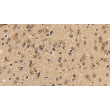 Acetylcholinesterase (ACHE) Mouse Polyclonal Antibody