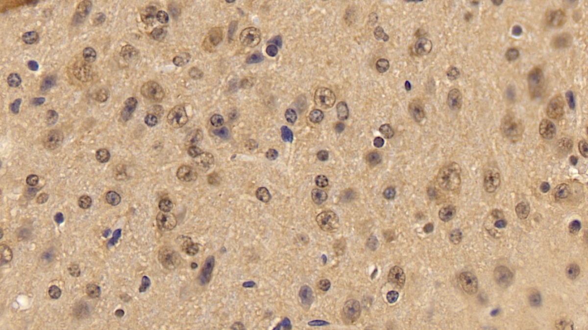 Acetylcholinesterase (ACHE) Mouse Polyclonal Antibody
