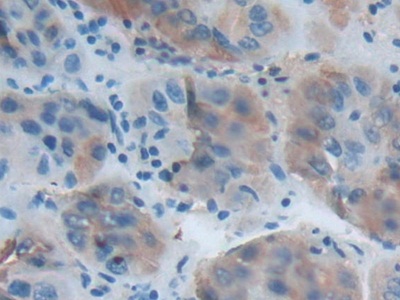 Acetylcholinesterase (ACHE) Rat Polyclonal Antibody