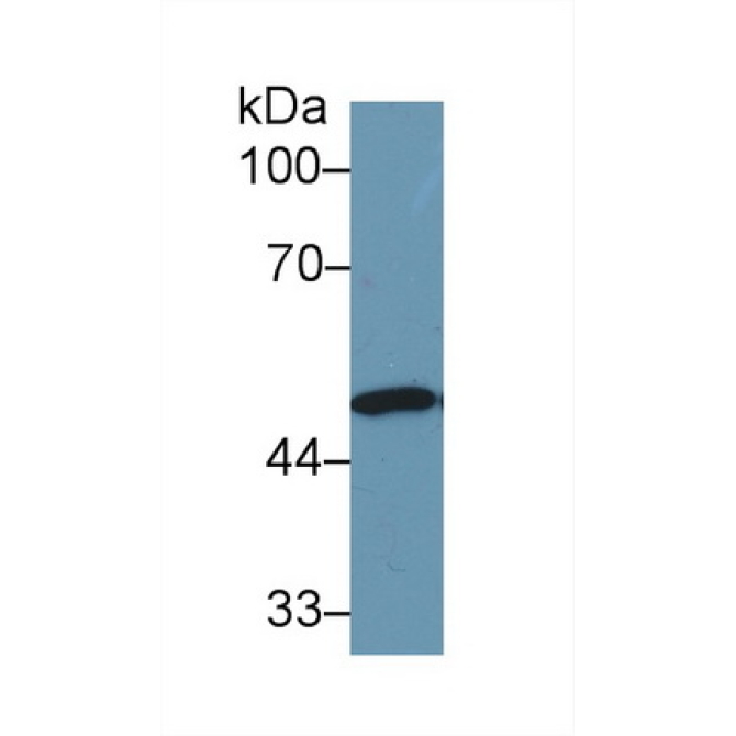 Enolase 1 (ENO1) Human Polyclonal Antibody
