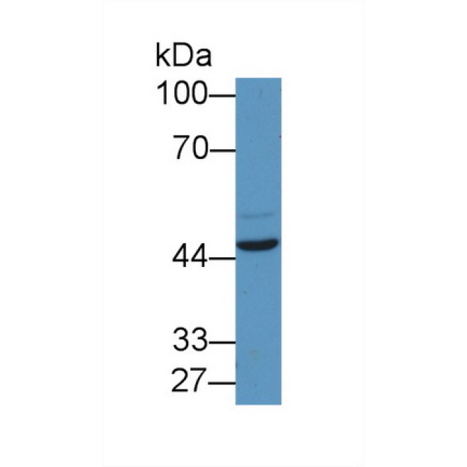 Early Growth Response Protein 2 (EGR2) Human Polyclonal Antibody