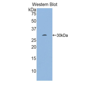 Early Growth Response Protein 2 (EGR2) Mouse Polyclonal Antibody