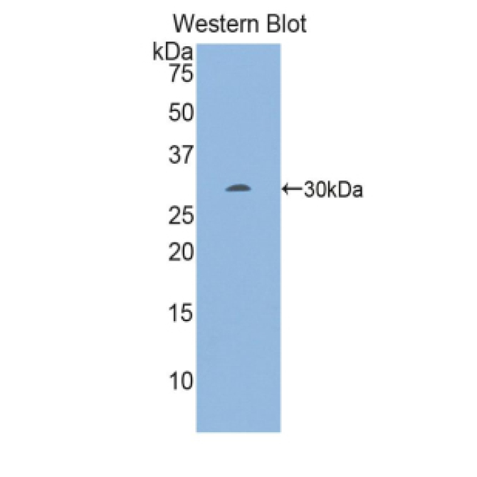 Early Growth Response Protein 2 (EGR2) Mouse Polyclonal Antibody