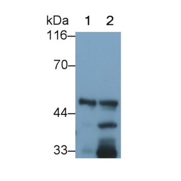 Pancreatic Lipase (PL) Mouse Polyclonal Antibody