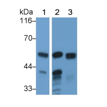 Amylase, Alpha 2A (AMY2A) Human Polyclonal Antibody
