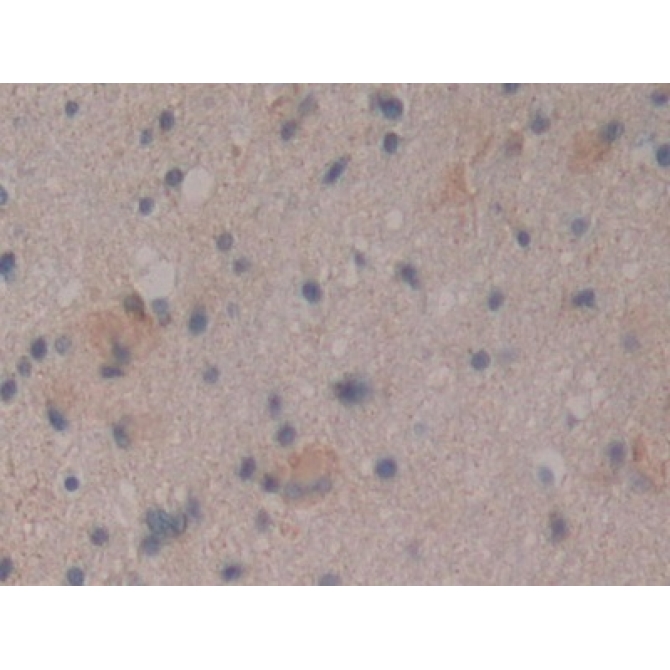 Cluster Of Differentiation 109 (CD109) Human Polyclonal Antibody