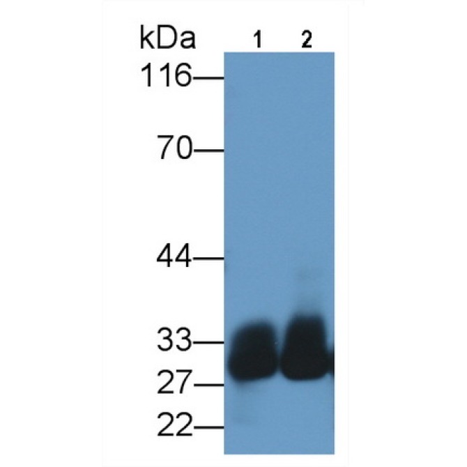 Azurocidin (AZU) Human Polyclonal Antibody