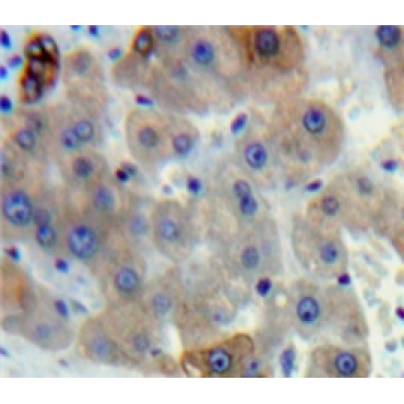Gamma-Lipotropic Hormone (gLPH) Human Polyclonal Antibody