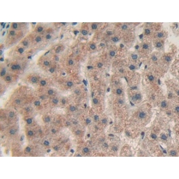 Chitinase-3-like Protein 1 (CHI3L1) Human Polyclonal Antibody