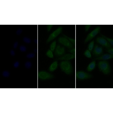 Lysosomal Associated Membrane Protein 2 (LAMP2) Human Polyclonal Antibody