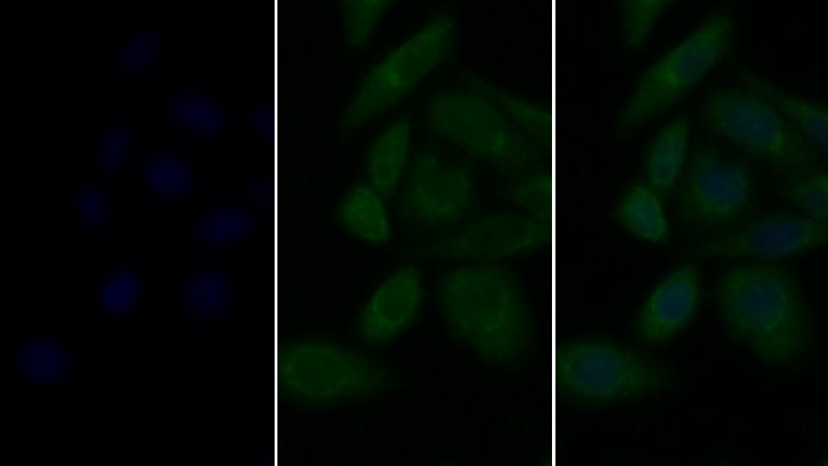 Lysosomal Associated Membrane Protein 2 (LAMP2) Human Polyclonal Antibody