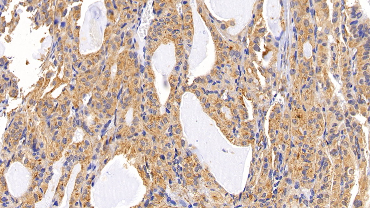 Lysosomal Associated Membrane Protein 2 (LAMP2) Human Polyclonal Antibody