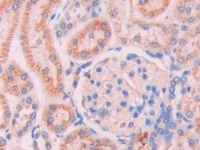 Lysosomal Associated Membrane Protein 2 (LAMP2) Rat Polyclonal Antibody