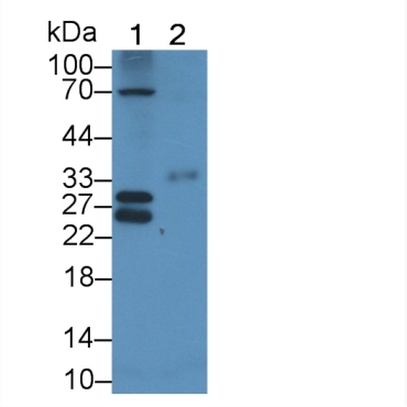 Connexin 31 (CX31) Human Polyclonal Antibody