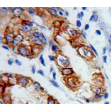 Connexin 31 (CX31) Human Polyclonal Antibody