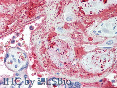 Thrombopoietin Receptor (TPOR) Mouse Polyclonal Antibody