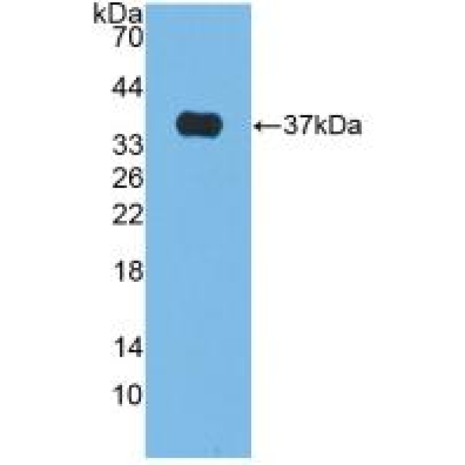 Alkaline Phosphatase (ALP) Bovine (Cattle) Polyclonal Antibody