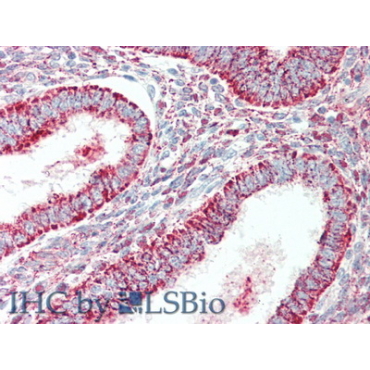 Alkaline Phosphatase (ALP) Human Polyclonal Antibody