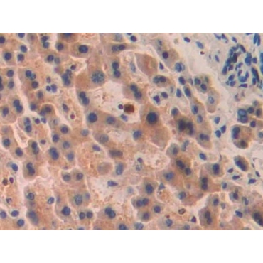 Pitrilysin Metalloproteinase 1 (MP1) Human Polyclonal Antibody