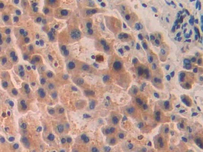 Pitrilysin Metalloproteinase 1 (MP1) Human Polyclonal Antibody