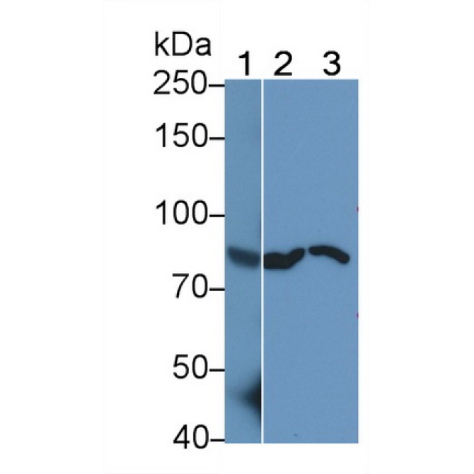 Colony Stimulating Factor Receptor, Granulocyte (GCSFR) Human Polyclonal Antibody