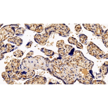 Colony Stimulating Factor Receptor, Granulocyte (GCSFR) Human Polyclonal Antibody