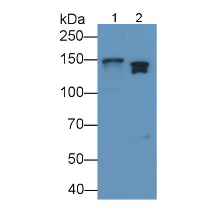 Colony Stimulating Factor Receptor, Granulocyte (GCSFR) Mouse Polyclonal Antibody