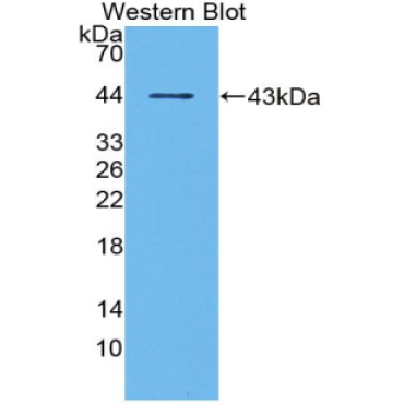 Matrix Gla Protein (MGP) Bovine (Cattle) Polyclonal Antibody