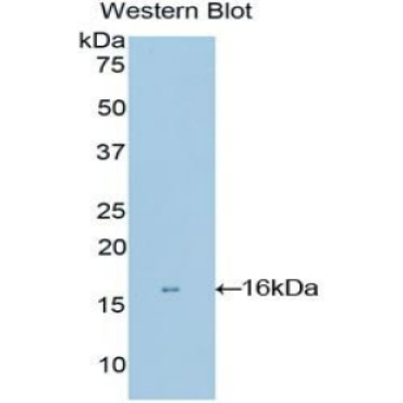 Matrix Gla Protein (MGP) Human Polyclonal Antibody