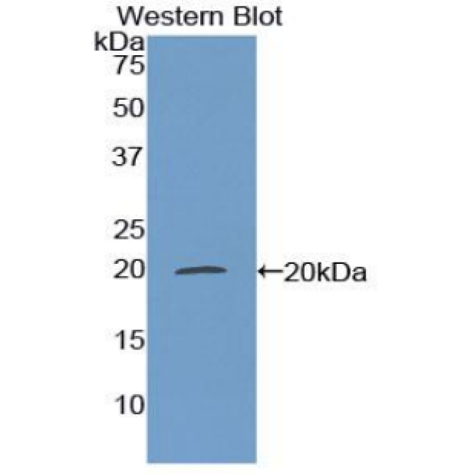 Matrix Gla Protein (MGP) Mouse Polyclonal Antibody