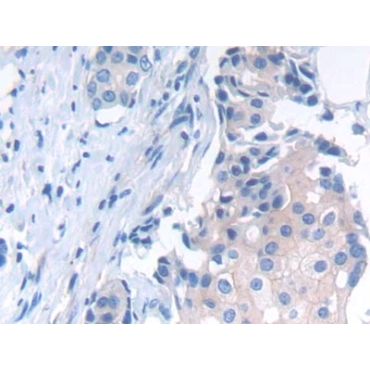 N-cadherin (NCAD) Human Polyclonal Antibody