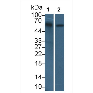 Salivary Alpha Amylase (AMY1A) Human Polyclonal Antibody