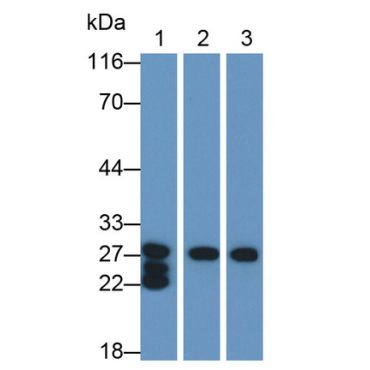 Pancreatic Elastase 1 (ELA1) Mouse Polyclonal Antibody