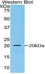 Colony Stimulating Factor Receptor, Macrophage (MCSFR) Rat Polyclonal Antibody