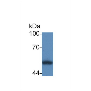 Calreticulin (CALR) Human Polyclonal Antibody