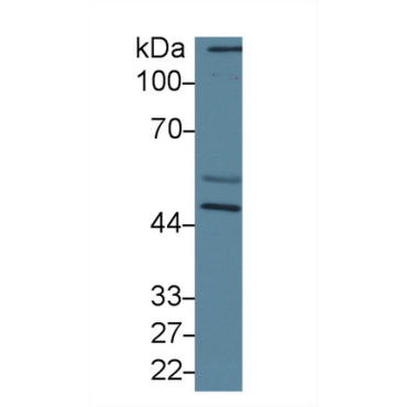 Calreticulin (CALR) Human Polyclonal Antibody
