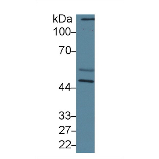 Calreticulin (CALR) Human Polyclonal Antibody