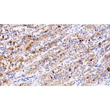Colony Stimulating Factor 2 Receptor Alpha (CSF2Ra) Human Polyclonal Antibody