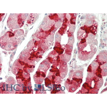 Mucin 6 (MUC6) Human Polyclonal Antibody