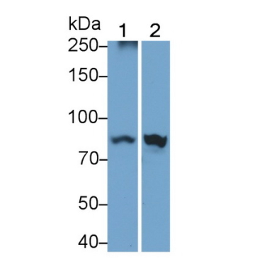 Interferon Gamma Receptor 1 (IFNgR1) Human Polyclonal Antibody