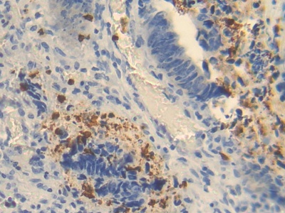 Ornithine Transcarbamylase (OTC) Human Polyclonal Antibody