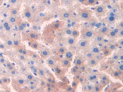 Ornithine Transcarbamylase (OTC) Mouse Polyclonal Antibody