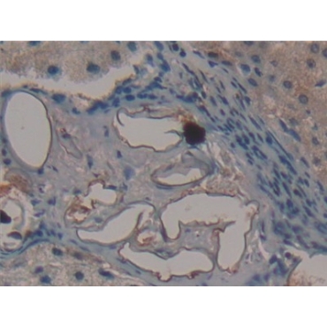 Fibromodulin (FMOD) Human Polyclonal Antibody