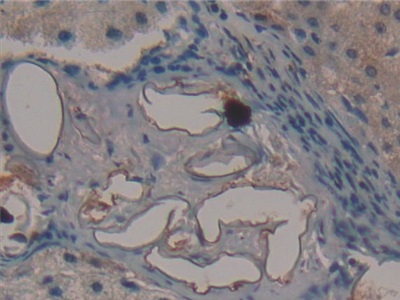 Fibromodulin (FMOD) Human Polyclonal Antibody