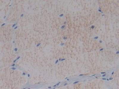 Fibromodulin (FMOD) Rat Polyclonal Antibody