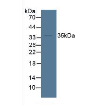 Sorbitol Dehydrogenase (SDH) Human Polyclonal Antibody