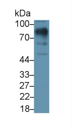 Lumican (LUM) Human Polyclonal Antibody