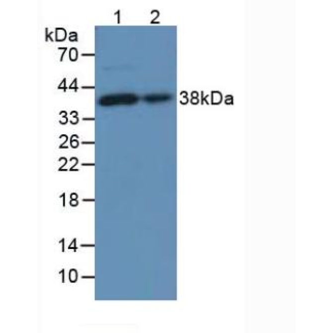 Lumican (LUM) Mouse Polyclonal Antibody