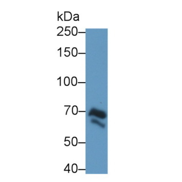 Dystrophin (DMD) Human Polyclonal Antibody