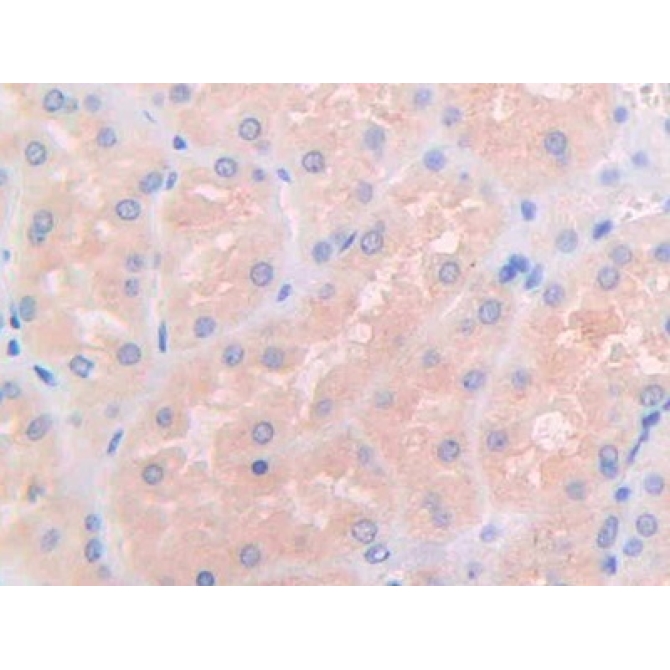 Interleukin 3 Receptor Alpha (IL3Ra) Human Polyclonal Antibody